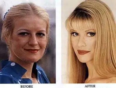 Woman with the most cosmetic procedures